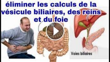 comment éliminer les calculs de la vésicule biliaire du foie et des